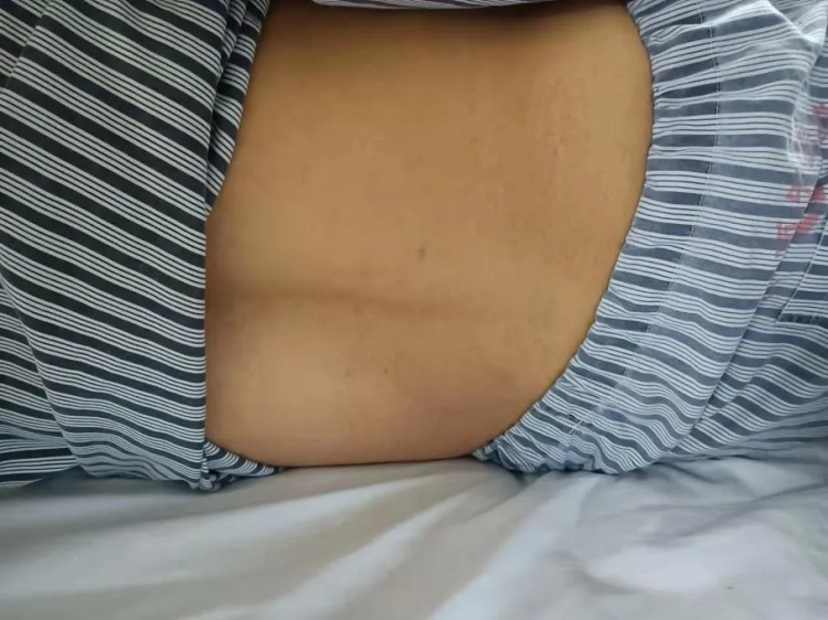 中药热奄包技术（干法）